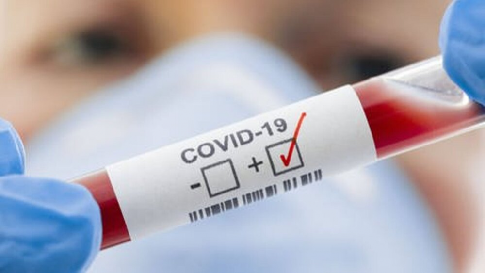 З підозрою на коронавірус до медиків звернулось 52 особи