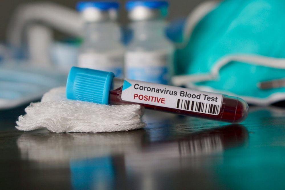 З підозрою на коронавірус госпіталізували 57 осіб